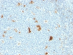S100A8/A9 Antibody (SPM281), Novus Biologicals:Antibodies:Primary Antibodies